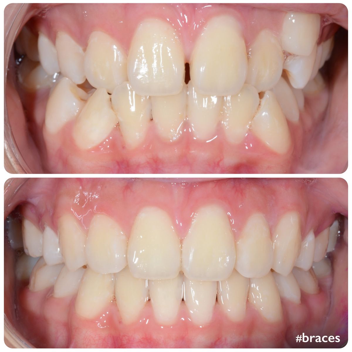 smile transformation